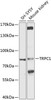 Western blot analysis of extracts of various cell lines, using TRPC1 antibody (23-996) at 1:1000 dilution.<br/>Secondary antibody: HRP Goat Anti-Rabbit IgG (H+L) at 1:10000 dilution.<br/>Lysates/proteins: 25ug per lane.<br/>Blocking buffer: 3% nonfat dry milk in TBST.<br/>Detection: ECL Basic Kit.<br/>Exposure time: 30s.
