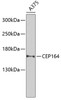 Western blot analysis of extracts of A-375 cells, using CEP164 Antibody (23-999) at 1:1000 dilution.<br/>Secondary antibody: HRP Goat Anti-Rabbit IgG (H+L) at 1:10000 dilution.<br/>Lysates/proteins: 25ug per lane.<br/>Blocking buffer: 3% nonfat dry milk in TBST.<br/>Detection: ECL Basic Kit.<br/>Exposure time: 90s.