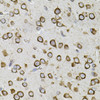 Immunohistochemistry of paraffin-embedded mouse brain using CEP164 antibody (23-999) (40x lens) .