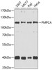 Western blot analysis of extracts of various cell lines, using PMPCA antibody (24-001) at 1:1000 dilution.<br/>Secondary antibody: HRP Goat Anti-Rabbit IgG (H+L) at 1:10000 dilution.<br/>Lysates/proteins: 25ug per lane.<br/>Blocking buffer: 3% nonfat dry milk in TBST.<br/>Detection: ECL Basic Kit.<br/>Exposure time: 30s.