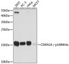 Western blot analysis of extracts of various cell lines, using ADAM10 antibody (24-023) at 1:1000 dilution.<br />Secondary antibody: HRP Goat Anti-Rabbit IgG (H+L) (AS014) at 1:10000 dilution.<br />Lysates/proteins: 25ug per lane.<br />Blocking buffer: 3% nonfat dry milk in TBST.<br />Detection: ECL Basic Kit.<br />Exposure time: 30s.