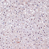 Immunohistochemistry of paraffin-embedded Rat liver using CDKN2A / p16INK4a antibody (24-023) at dilution of 1:100 (40x lens) .