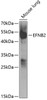 Western blot analysis of extracts of mouse lung, using EFNB2 antibody (19-783) at 1:1000 dilution.<br/>Secondary antibody: HRP Goat Anti-Rabbit IgG (H+L) at 1:10000 dilution.<br/>Lysates/proteins: 25ug per lane.<br/>Blocking buffer: 3% nonfat dry milk in TBST.