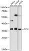 Western blot analysis of extracts of various cell lines, using TYMS antibody (13-007) at 1:1000 dilution.<br/>Secondary antibody: HRP Goat Anti-Rabbit IgG (H+L) at 1:10000 dilution.<br/>Lysates/proteins: 25ug per lane.<br/>Blocking buffer: 3% nonfat dry milk in TBST.<br/>Detection: ECL Basic Kit.<br/>Exposure time: 90s.