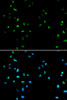 Immunofluorescence analysis of A549 cells using HDAC4 antibody (13-099) . Blue: DAPI for nuclear staining.