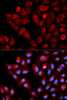 Immunofluorescence analysis of HeLa cells using TBRG4 antibody (13-122) . Blue: DAPI for nuclear staining.