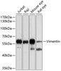 Western blot analysis of extracts of various cell lines, using Vimentin antibody (13-144) at 1:500 dilution.<br/>Secondary antibody: HRP Goat Anti-Rabbit IgG (H+L) at 1:10000 dilution.<br/>Lysates/proteins: 25ug per lane.<br/>Blocking buffer: 3% nonfat dry milk in TBST.<br/>Detection: ECL Basic Kit.<br/>Exposure time: 60s.