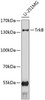 Western blot analysis of extracts of U-251MG cells, using TrkB antibody (13-184) at 1:1000 dilution.<br/>Secondary antibody: HRP Goat Anti-Mouse IgG (H+L) (AS003) at 1:10000 dilution.<br/>Lysates/proteins: 25ug per lane.<br/>Blocking buffer: 3% nonfat dry milk in TBST.<br/>Detection: ECL Enhanced Kit.<br/>Exposure time: 90s.