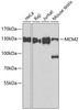 Western blot analysis of extracts of various cell lines, using MCM2 antibody (13-187) at 1:500 dilution.<br/>Secondary antibody: HRP Goat Anti-Rabbit IgG (H+L) at 1:10000 dilution.<br/>Lysates/proteins: 25ug per lane.<br/>Blocking buffer: 3% nonfat dry milk in TBST.<br/>Detection: ECL Basic Kit.<br/>Exposure time: 90s.