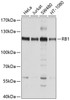 Western blot analysis of extracts of various cell lines, using RB1 antibody (13-425) at 1:1000 dilution.<br/>Secondary antibody: HRP Goat Anti-Rabbit IgG (H+L) at 1:10000 dilution.<br/>Lysates/proteins: 25ug per lane.<br/>Blocking buffer: 3% nonfat dry milk in TBST.<br/>Detection: ECL Basic Kit.<br/>Exposure time: 10s.