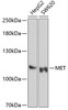 Western blot analysis of extracts of various cell lines, using MET Antibody (13-495) at 1:1000 dilution.<br/>Secondary antibody: HRP Goat Anti-Mouse IgG (H+L) (AS003) at 1:10000 dilution.<br/>Lysates/proteins: 25ug per lane.<br/>Blocking buffer: 3% nonfat dry milk in TBST.<br/>Detection: ECL Enhanced Kit.<br/>Exposure time: 30s.