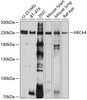 Western blot analysis of extracts of various cell lines, using ABCA4 antibody (13-720) at 1:1000 dilution.<br/>Secondary antibody: HRP Goat Anti-Rabbit IgG (H+L) at 1:10000 dilution.<br/>Lysates/proteins: 25ug per lane.<br/>Blocking buffer: 3% nonfat dry milk in TBST.<br/>Detection: ECL Basic Kit.<br/>Exposure time: 10s.