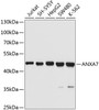 Western blot analysis of extracts of various cell lines, using ANXA7 Antibody (13-781) at 1:1000 dilution.<br/>Secondary antibody: HRP Goat Anti-Rabbit IgG (H+L) at 1:10000 dilution.<br/>Lysates/proteins: 25ug per lane.<br/>Blocking buffer: 3% nonfat dry milk in TBST.<br/>Detection: ECL Basic Kit.<br/>Exposure time: 10s.