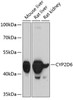 Western blot analysis of extracts of various cell lines, using CYP2D6 antibody (13-837) at 1:1000 dilution.<br/>Secondary antibody: HRP Goat Anti-Rabbit IgG (H+L) at 1:10000 dilution.<br/>Lysates/proteins: 25ug per lane.<br/>Blocking buffer: 3% nonfat dry milk in TBST.<br/>Detection: ECL Basic Kit.<br/>Exposure time: 90s.