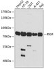 Western blot analysis of extracts of various cell lines, using PIGR antibody (13-848) at 1:1000 dilution.<br/>Secondary antibody: HRP Goat Anti-Rabbit IgG (H+L) at 1:10000 dilution.<br/>Lysates/proteins: 25ug per lane.<br/>Blocking buffer: 3% nonfat dry milk in TBST.<br/>Detection: ECL Basic Kit.<br/>Exposure time: 30s.