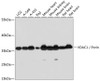 Western blot analysis of extracts of various cell lines, using VDAC1 / Porin antibody (13-960) at 1:1000 dilution.<br/>Secondary antibody: HRP Goat Anti-Rabbit IgG (H+L) at 1:10000 dilution.<br/>Lysates/proteins: 25ug per lane.<br/>Blocking buffer: 3% nonfat dry milk in TBST.<br/>Detection: ECL Basic Kit.<br/>Exposure time: 10s.