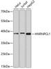 Western blot analysis of extracts of various cell lines, using HNRNPCL1 antibody (14-148) at 1:1000 dilution.<br/>Secondary antibody: HRP Goat Anti-Rabbit IgG (H+L) at 1:10000 dilution.<br/>Lysates/proteins: 25ug per lane.<br/>Blocking buffer: 3% nonfat dry milk in TBST.<br/>Detection: ECL Enhanced Kit.<br/>Exposure time: 90s.