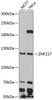 Western blot analysis of extracts of various cell lines, using ZNF217 antibody (14-151) at 1:1000 dilution.<br/>Secondary antibody: HRP Goat Anti-Rabbit IgG (H+L) at 1:10000 dilution.<br/>Lysates/proteins: 25ug per lane.<br/>Blocking buffer: 3% nonfat dry milk in TBST.<br/>Detection: ECL Enhanced Kit.<br/>Exposure time: 90s.