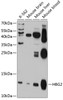 Western blot analysis of extracts of various cell lines, using HBG2 antibody (14-155) at 1:1000 dilution.<br/>Secondary antibody: HRP Goat Anti-Rabbit IgG (H+L) at 1:10000 dilution.<br/>Lysates/proteins: 25ug per lane.<br/>Blocking buffer: 3% nonfat dry milk in TBST.<br/>Detection: ECL Basic Kit.<br/>Exposure time: 30s.