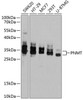 Western blot analysis of extracts of various cell lines, using PNMT antibody (14-158) at 1:1000 dilution.<br/>Secondary antibody: HRP Goat Anti-Rabbit IgG (H+L) at 1:10000 dilution.<br/>Lysates/proteins: 25ug per lane.<br/>Blocking buffer: 3% nonfat dry milk in TBST.<br/>Detection: ECL Basic Kit.<br/>Exposure time: 90s.