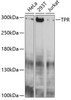 Western blot analysis of extracts of various cell lines, using TPR antibody (14-160) at 1:1000 dilution.<br/>Secondary antibody: HRP Goat Anti-Rabbit IgG (H+L) at 1:10000 dilution.<br/>Lysates/proteins: 25ug per lane.<br/>Blocking buffer: 3% nonfat dry milk in TBST.<br/>Detection: ECL Basic Kit.<br/>Exposure time: 30s.