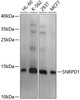 Western blot analysis of extracts of various cell lines, using SNRPD1 antibody (14-162) at 1:1000 dilution.<br/>Secondary antibody: HRP Goat Anti-Rabbit IgG (H+L) at 1:10000 dilution.<br/>Lysates/proteins: 25ug per lane.<br/>Blocking buffer: 3% nonfat dry milk in TBST.<br/>Detection: ECL Basic Kit.<br/>Exposure time: 3s.
