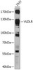 Western blot analysis of extracts of 293T cells, using VLDLR antibody (14-166) at 1:1000 dilution.<br/>Secondary antibody: HRP Goat Anti-Rabbit IgG (H+L) at 1:10000 dilution.<br/>Lysates/proteins: 25ug per lane.<br/>Blocking buffer: 3% nonfat dry milk in TBST.<br/>Detection: ECL Basic Kit.<br/>Exposure time: 90s.