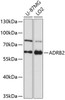 Western blot analysis of extracts of various cell lines, using ADRB2 antibody (14-719) at 1:1000 dilution.<br/>Secondary antibody: HRP Goat Anti-Rabbit IgG (H+L) at 1:10000 dilution.<br/>Lysates/proteins: 25ug per lane.<br/>Blocking buffer: 3% nonfat dry milk in TBST.<br/>Detection: ECL Basic Kit.<br/>Exposure time: 90s.