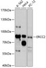 Western blot analysis of extracts of various cell lines, using ERCC2 antibody (14-917) at 1:1000 dilution.<br/>Secondary antibody: HRP Goat Anti-Rabbit IgG (H+L) at 1:10000 dilution.<br/>Lysates/proteins: 25ug per lane.<br/>Blocking buffer: 3% nonfat dry milk in TBST.<br/>Detection: ECL Enhanced Kit.<br/>Exposure time: 90s.