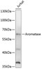 Western blot analysis of extracts of Jurkat cells, using Aromatase antibody (14-945) at 1:1000 dilution.<br/>Secondary antibody: HRP Goat Anti-Rabbit IgG (H+L) at 1:10000 dilution.<br/>Lysates/proteins: 25ug per lane.<br/>Blocking buffer: 3% nonfat dry milk in TBST.<br/>Detection: ECL Basic Kit.<br/>Exposure time: 1s.