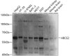 Western blot analysis of extracts of various cell lines, using ABCG2 antibody (15-157) at 1:1000 dilution.<br/>Secondary antibody: HRP Goat Anti-Rabbit IgG (H+L) at 1:10000 dilution.<br/>Lysates/proteins: 25ug per lane.<br/>Blocking buffer: 3% nonfat dry milk in TBST.<br/>Detection: ECL Basic Kit.<br/>Exposure time: 5s.