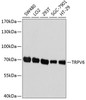 Western blot analysis of extracts of various cell lines, using TRPV6 antibody (15-801) at 1:1000 dilution.<br/>Secondary antibody: HRP Goat Anti-Rabbit IgG (H+L) at 1:10000 dilution.<br/>Lysates/proteins: 25ug per lane.<br/>Blocking buffer: 3% nonfat dry milk in TBST.<br/>Detection: ECL Basic Kit.<br/>Exposure time: 1s.