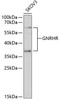 Western blot analysis of extracts of SKOV3 cells, using GNRHR Antibody (16-813) at 1:1000 dilution.<br/>Secondary antibody: HRP Goat Anti-Rabbit IgG (H+L) at 1:10000 dilution.<br/>Lysates/proteins: 25ug per lane.<br/>Blocking buffer: 3% nonfat dry milk in TBST.<br/>Detection: ECL Basic Kit.<br/>Exposure time: 30s.