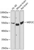 Western blot analysis of extracts of various cell lines, using MEF2C antibody (18-572) at 1:1000 dilution.<br/>Secondary antibody: HRP Goat Anti-Rabbit IgG (H+L) at 1:10000 dilution.<br/>Lysates/proteins: 25ug per lane.<br/>Blocking buffer: 3% nonfat dry milk in TBST.<br/>Detection: ECL Basic Kit.<br/>Exposure time: 90s.