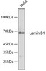 Western blot analysis of extracts of HeLa cells, using Lamin B1 antibody (18-653) .<br/>Secondary antibody: HRP Goat Anti-Rabbit IgG (H+L) at 1:10000 dilution.<br/>Lysates/proteins: 25ug per lane.<br/>Blocking buffer: 3% nonfat dry milk in TBST.