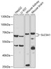 Western blot analysis of extracts of various cell lines, using SLC5A1 antibody (18-954) at 1:500 dilution.<br/>Secondary antibody: HRP Goat Anti-Rabbit IgG (H+L) at 1:10000 dilution.<br/>Lysates/proteins: 25ug per lane.<br/>Blocking buffer: 3% nonfat dry milk in TBST.<br/>Detection: ECL Basic Kit.<br/>Exposure time: 120s.