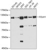 Western blot analysis of extracts of various cell lines, using FOLH1 antibody (18-999) at 1:1000 dilution.<br/>Secondary antibody: HRP Goat Anti-Rabbit IgG (H+L) at 1:10000 dilution.<br/>Lysates/proteins: 25ug per lane.<br/>Blocking buffer: 3% nonfat dry milk in TBST.<br/>Detection: ECL Basic Kit.<br/>Exposure time: 90s.