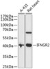 Western blot analysis of extracts of various cell lines, using IFNGR2 antibody (19-216) at 1:1000 dilution.<br/>Secondary antibody: HRP Goat Anti-Rabbit IgG (H+L) at 1:10000 dilution.<br/>Lysates/proteins: 25ug per lane.<br/>Blocking buffer: 3% nonfat dry milk in TBST.<br/>Detection: ECL Basic Kit.<br/>Exposure time: 90s.