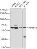Western blot analysis of extracts of various cell lines, using PIP5K1B Antibody (19-311) at 1:1000 dilution.<br/>Secondary antibody: HRP Goat Anti-Rabbit IgG (H+L) at 1:10000 dilution.<br/>Lysates/proteins: 25ug per lane.<br/>Blocking buffer: 3% nonfat dry milk in TBST.<br/>Detection: ECL Basic Kit.<br/>Exposure time: 5s.