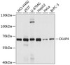 Western blot analysis of extracts of various cell lines, using CKAP4 antibody (19-386) at 1:1000 dilution.<br/>Secondary antibody: HRP Goat Anti-Rabbit IgG (H+L) at 1:10000 dilution.<br/>Lysates/proteins: 25ug per lane.<br/>Blocking buffer: 3% nonfat dry milk in TBST.<br/>Detection: ECL Basic Kit.<br/>Exposure time: 5s.