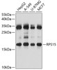 Western blot analysis of extracts of various cell lines, using RPS15 antibody (19-953) at 1:1000 dilution.<br/>Secondary antibody: HRP Goat Anti-Rabbit IgG (H+L) at 1:10000 dilution.<br/>Lysates/proteins: 25ug per lane.<br/>Blocking buffer: 3% nonfat dry milk in TBST.<br/>Detection: ECL Basic Kit.<br/>Exposure time: 30s.
