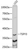 Western blot analysis of extracts of LO2 cells, using TSPY3 antibody (22-094) at 1:1000 dilution.<br/>Secondary antibody: HRP Goat Anti-Rabbit IgG (H+L) at 1:10000 dilution.<br/>Lysates/proteins: 25ug per lane.<br/>Blocking buffer: 3% nonfat dry milk in TBST.<br/>Detection: ECL Basic Kit.<br/>Exposure time: 30s.