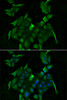 Immunofluorescence analysis of HeLa cells using SLC34A1 antibody (22-453) . Blue: DAPI for nuclear staining.