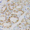 Immunohistochemistry of paraffin-embedded human stomach using MTCO2 antibody (23-118) at dilution of 1:100 (40x lens) .