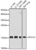 Western blot analysis of extracts of various cell lines, using EVA1A antibody (23-380) at 1:1000 dilution.<br/>Secondary antibody: HRP Goat Anti-Rabbit IgG (H+L) at 1:10000 dilution.<br/>Lysates/proteins: 25ug per lane.<br/>Blocking buffer: 3% nonfat dry milk in TBST.<br/>Detection: ECL Basic Kit.<br/>Exposure time: 90s.