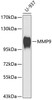 Western blot analysis of extracts of U-937 cells, using MMP9 antibody (13-140) .<br/>Secondary antibody: HRP Goat Anti-Rabbit IgG (H+L) at 1:10000 dilution.<br/>Lysates/proteins: 25ug per lane.<br/>Blocking buffer: 3% nonfat dry milk in TBST.