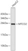 Western blot analysis of extracts of HepG2 cells, using MTCO2 antibody (13-193) .<br/>Secondary antibody: HRP Goat Anti-Rabbit IgG (H+L) at 1:10000 dilution.<br/>Lysates/proteins: 25ug per lane.<br/>Blocking buffer: 3% nonfat dry milk in TBST.