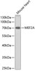 Western blot analysis of extracts of mouse heart, using MEF2A antibody (13-299) .<br/>Secondary antibody: HRP Goat Anti-Rabbit IgG (H+L) at 1:10000 dilution.<br/>Lysates/proteins: 25ug per lane.<br/>Blocking buffer: 3% nonfat dry milk in TBST.