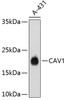 Western blot analysis of extracts of A-431 cells, using CAV1 antibody (13-796) .<br/>Secondary antibody: HRP Goat Anti-Rabbit IgG (H+L) at 1:10000 dilution.<br/>Lysates/proteins: 25ug per lane.<br/>Blocking buffer: 3% nonfat dry milk in TBST.