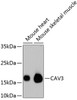 Western blot analysis of extracts of various cell lines, using CAV3 antibody (13-799) .<br/>Secondary antibody: HRP Goat Anti-Rabbit IgG (H+L) at 1:10000 dilution.<br/>Lysates/proteins: 25ug per lane.<br/>Blocking buffer: 3% nonfat dry milk in TBST.